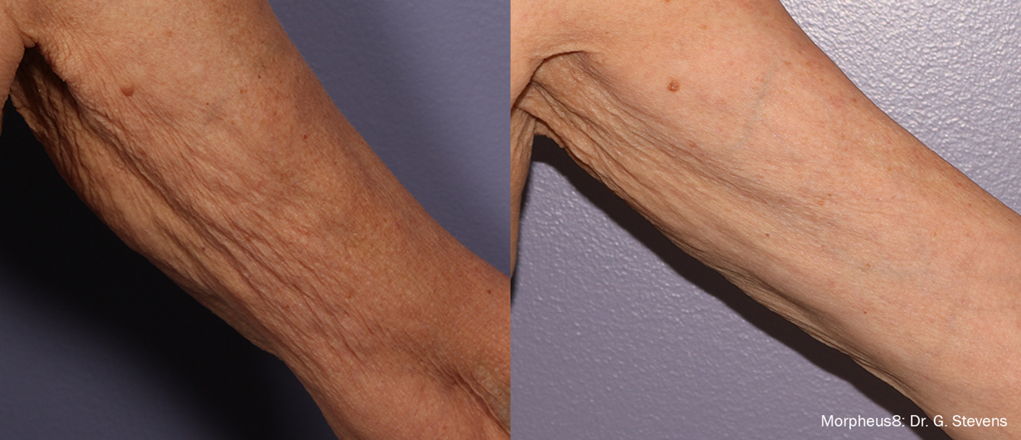 beforeAndAfter5