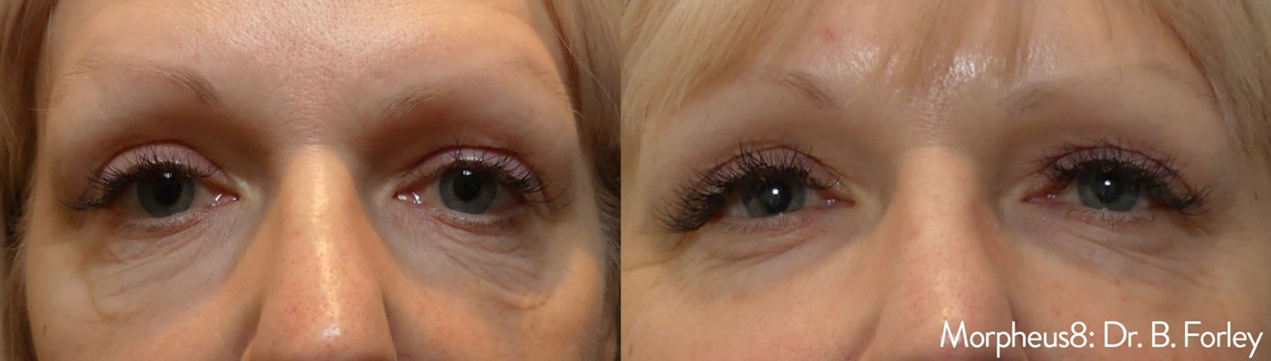beforeandAfter2