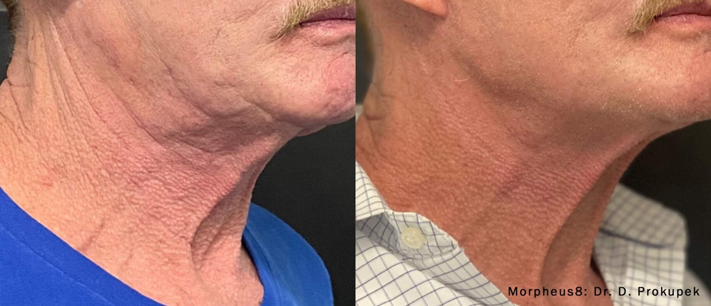 beforeandAfter3